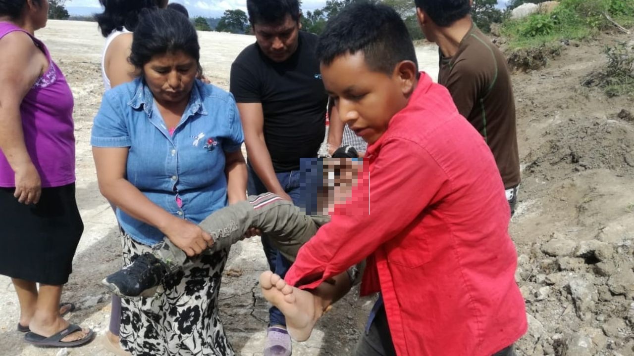 Niña sufre graves quemaduras tras subir a una torre del tendido eléctrico en La Paz