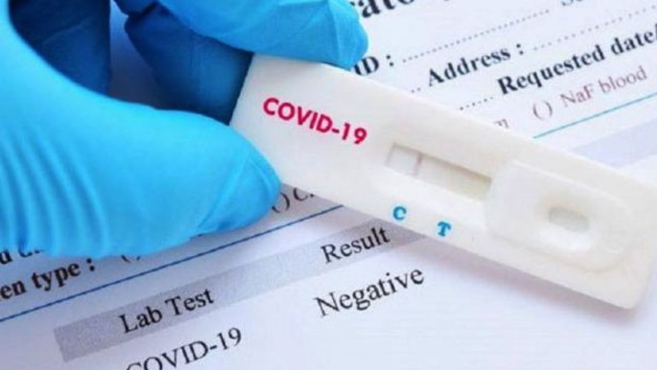 España entrega a Honduras 24 mil pruebas para diagnosticar covid-19