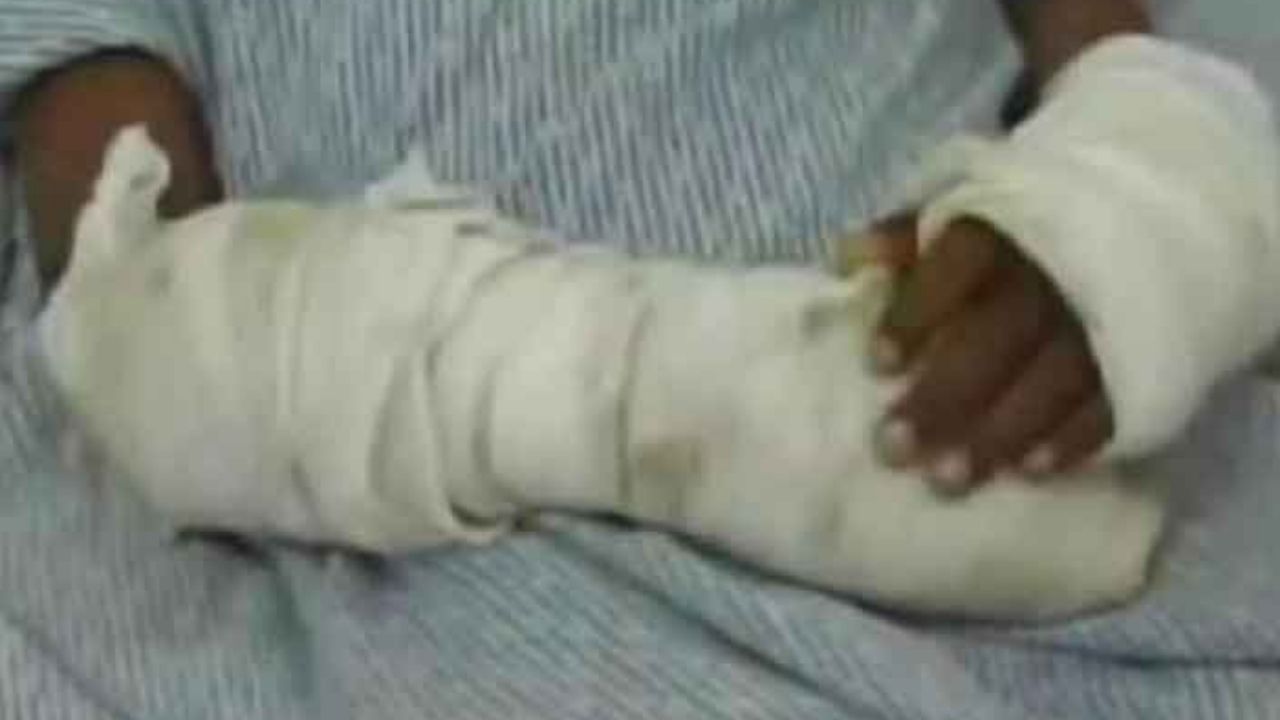 Hondureña machetea a su propia hija como castigo en Choluteca