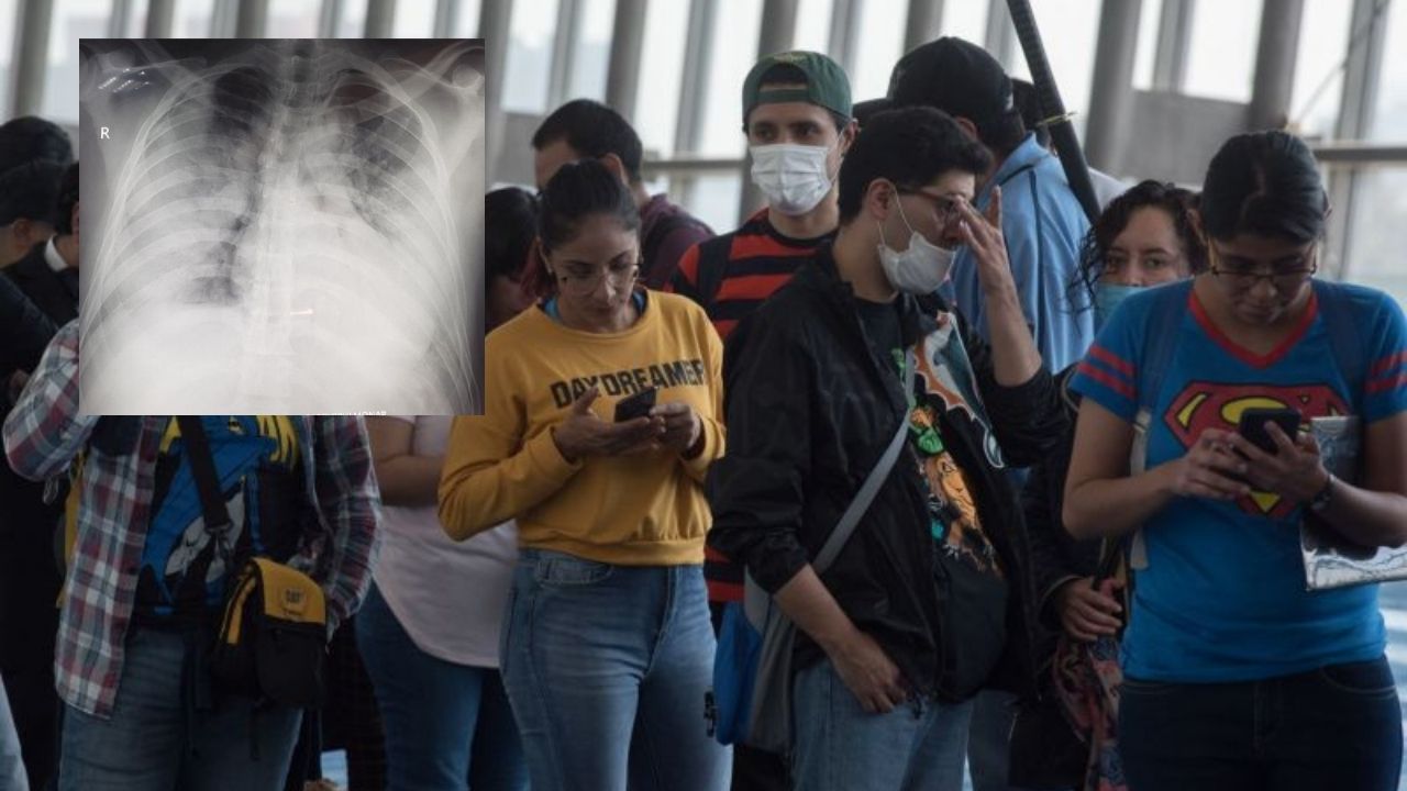 'Así nos están llegando los jóvenes, pulmones blancos ', dice la doctora Suyapa Sosa sobre aumento internos por covid