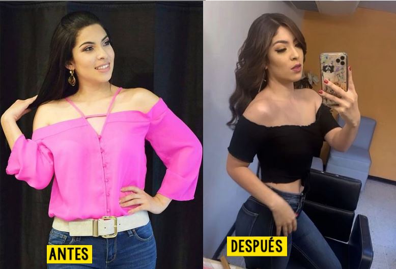 Imagen de cuerpo de nota