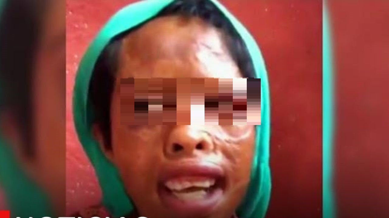 'Me dijo que no lo denunciara': testimonio de una niña que fue golpeada, quemada y vendida por su papá