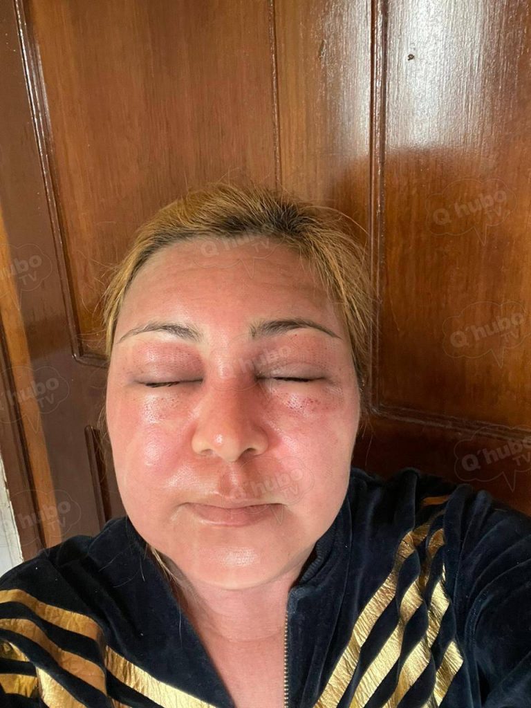 Imagen de cuerpo de nota