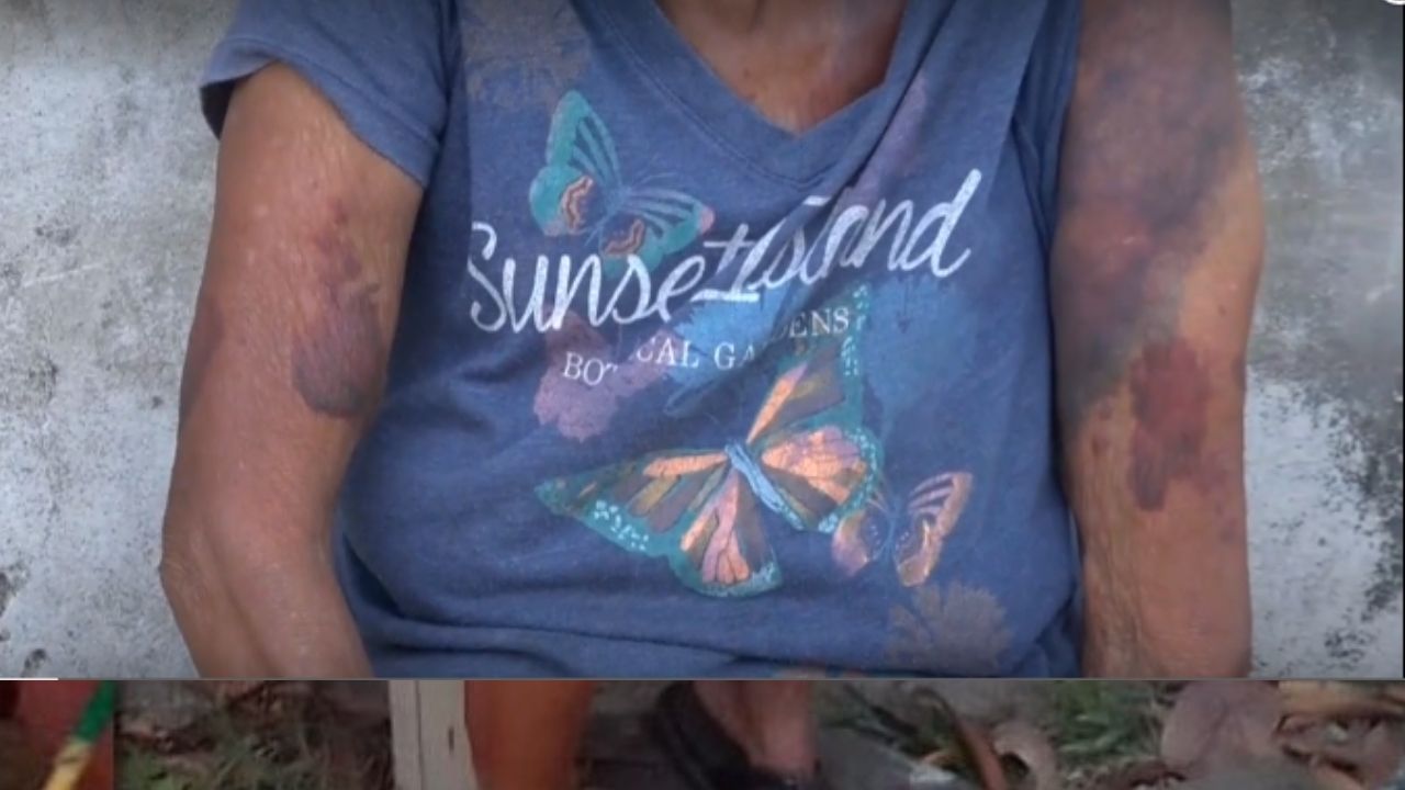 Abuela hondureña recibió tremenda golpiza por parte de vecinos en represalia contra sus hijos