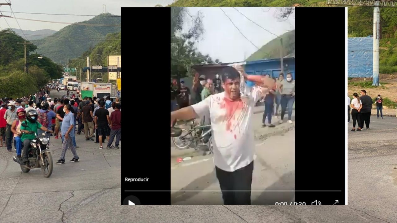 Con el rostro lleno de sangre, poblador de Chamelecón amenaza a políticos hondureños 'ninguno va entrar aquí'