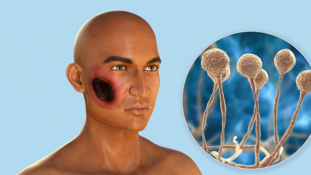 'Ella está en la UCI, necesitamos la mano de Dios', dice esposo de hondureña sospechosa de hongo negro