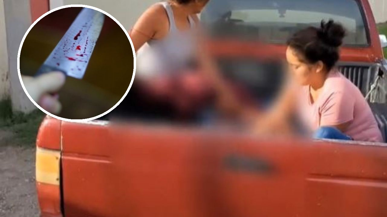 Hondureño le introdujo un cuchillo en la cabeza a su vecino durante una pelea en Copán