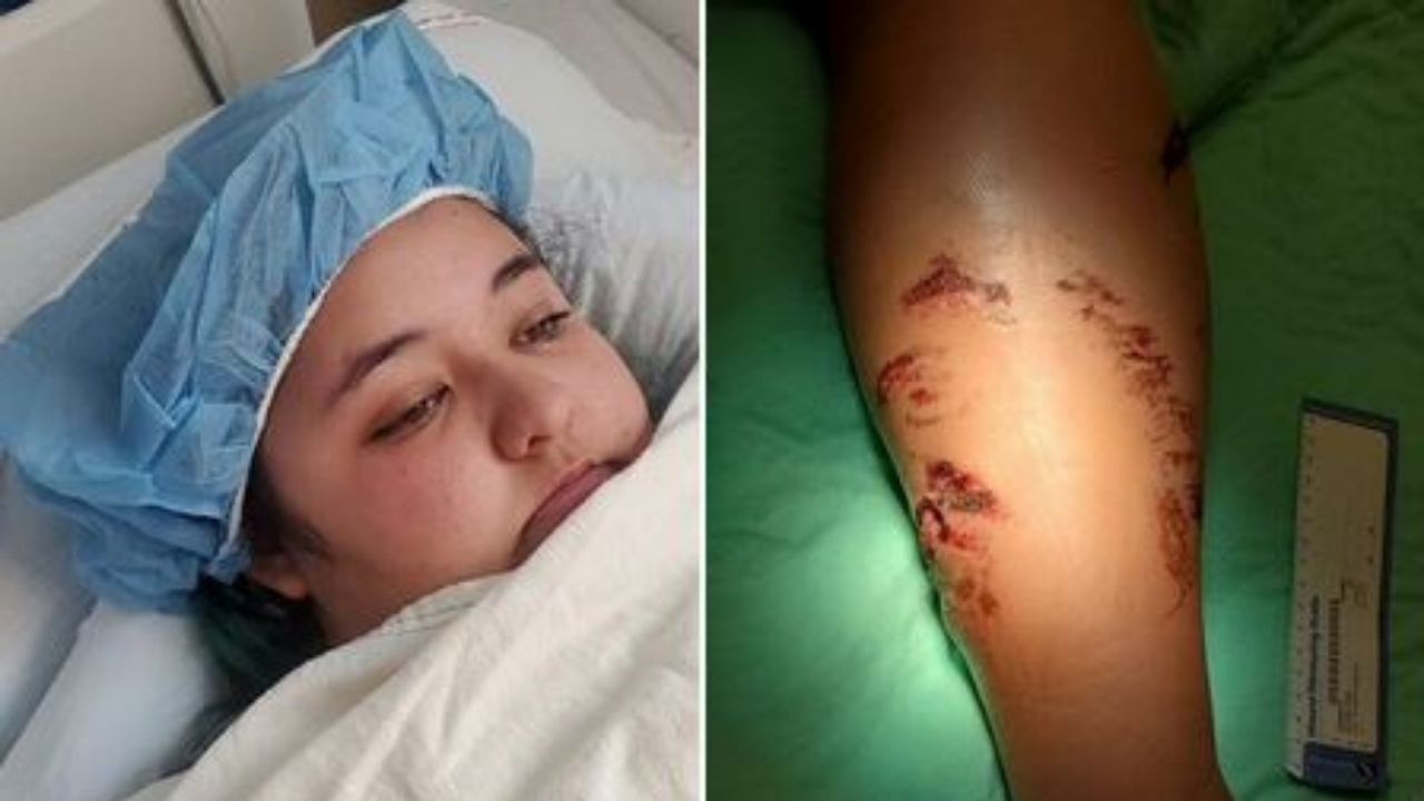 Cocodrilo de más de 2 metros ataca a turista en un playa de México