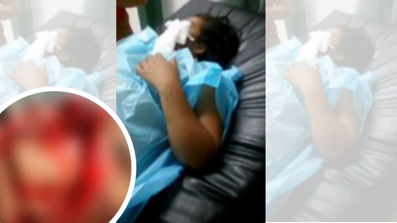 Hondureño atacó a machetazos a su exesposa y le desfiguró el rostro; madre de la víctima clama ayuda