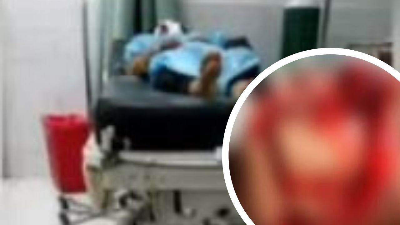 Celos, la causa por la cual hondureño desfiguró el rostro de su exmujer; 'la cortada es profunda y le arrancó dientes'