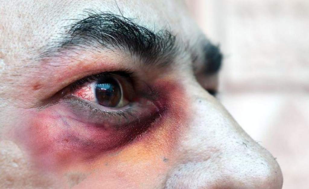 Imagen de cuerpo de nota