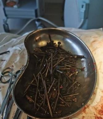 Imagen de cuerpo de nota