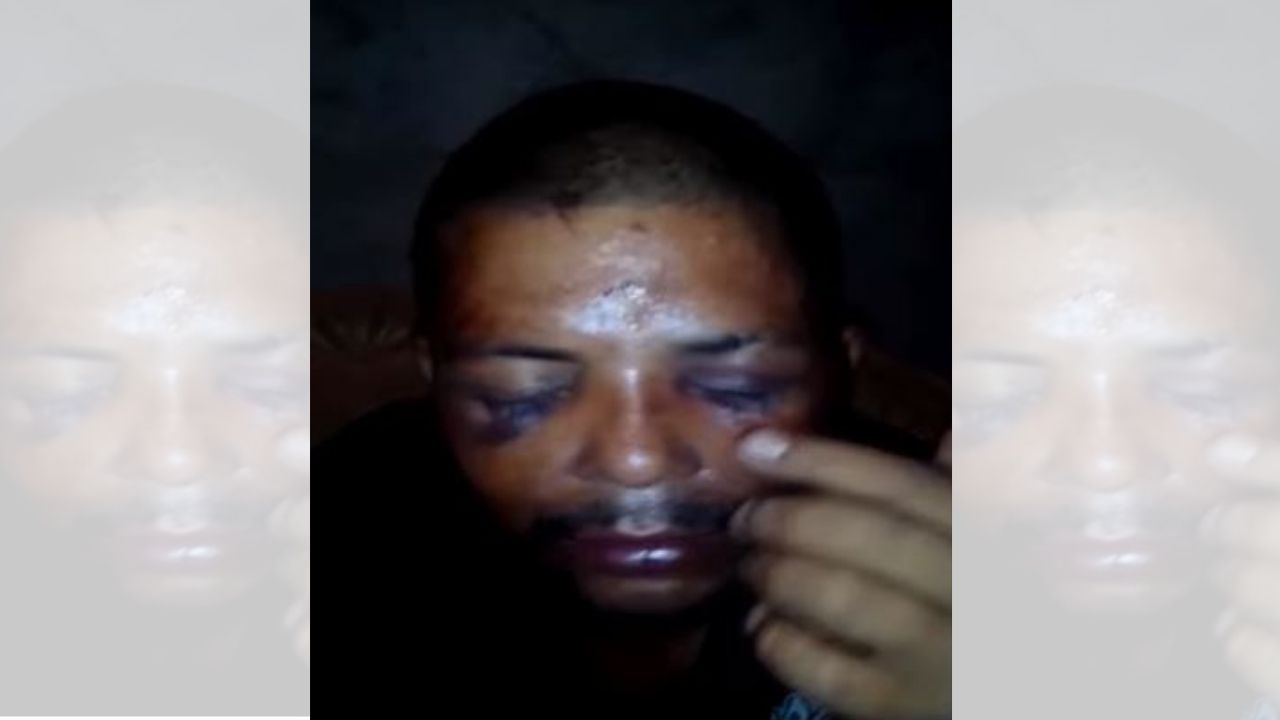 'Estoy jodido, pero me voy a recuperar': hondureño golpeado por su esposa rompe el silencio