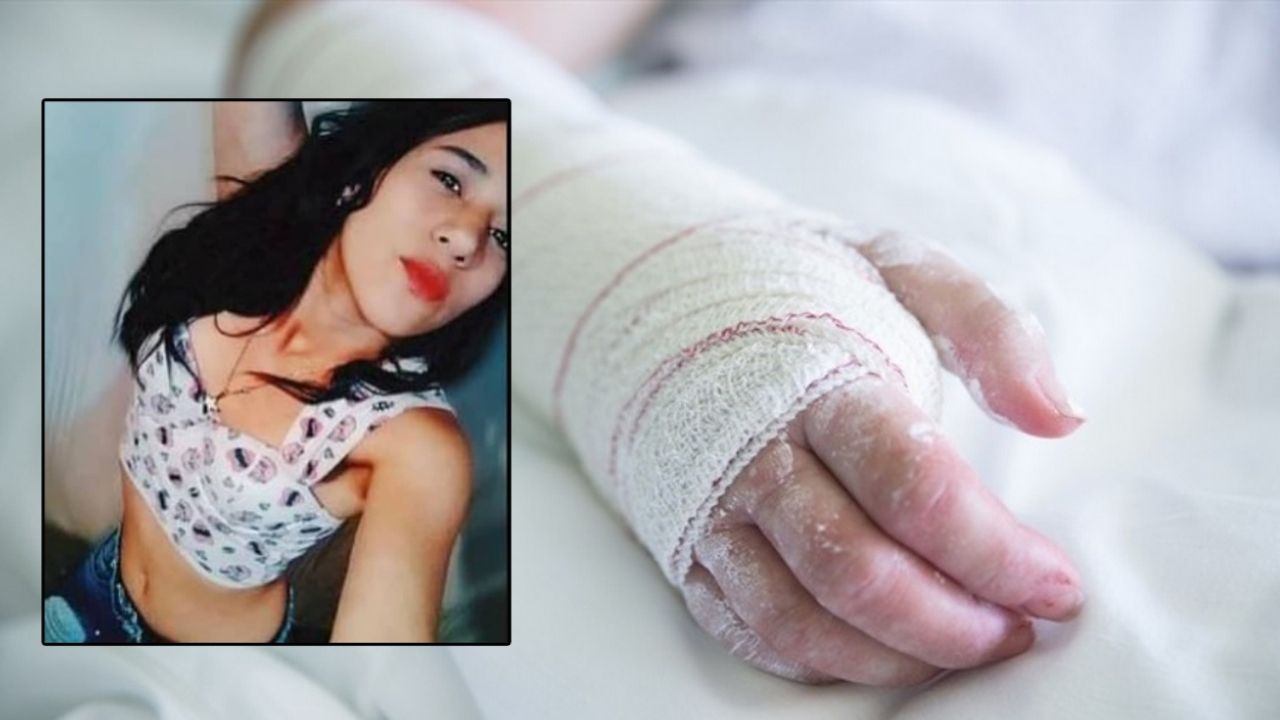 Hombre roció a su mujer con líquido inflamable porque no quiso lavar platos en la madrugada