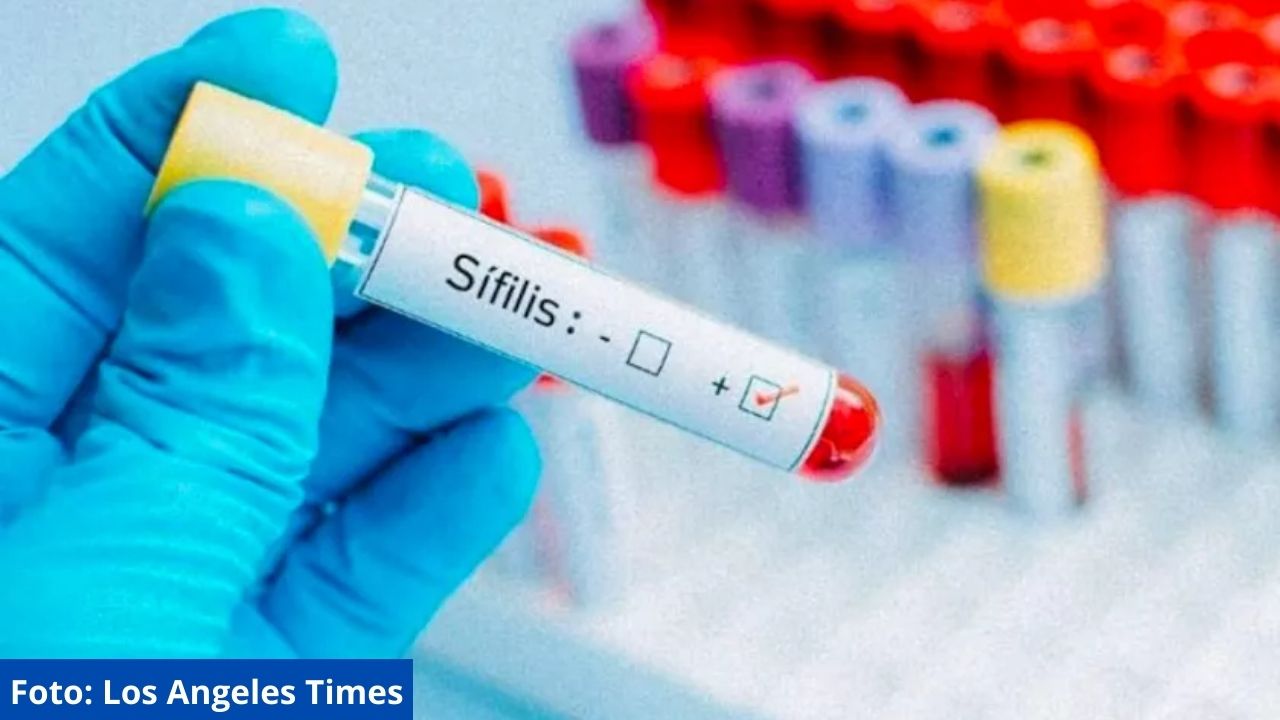 Salud reporta incremento en casos de sífilis en la zona sur de Honduras