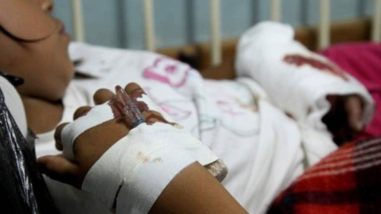 90 por ciento de ocupación por quemados reportan autoridades