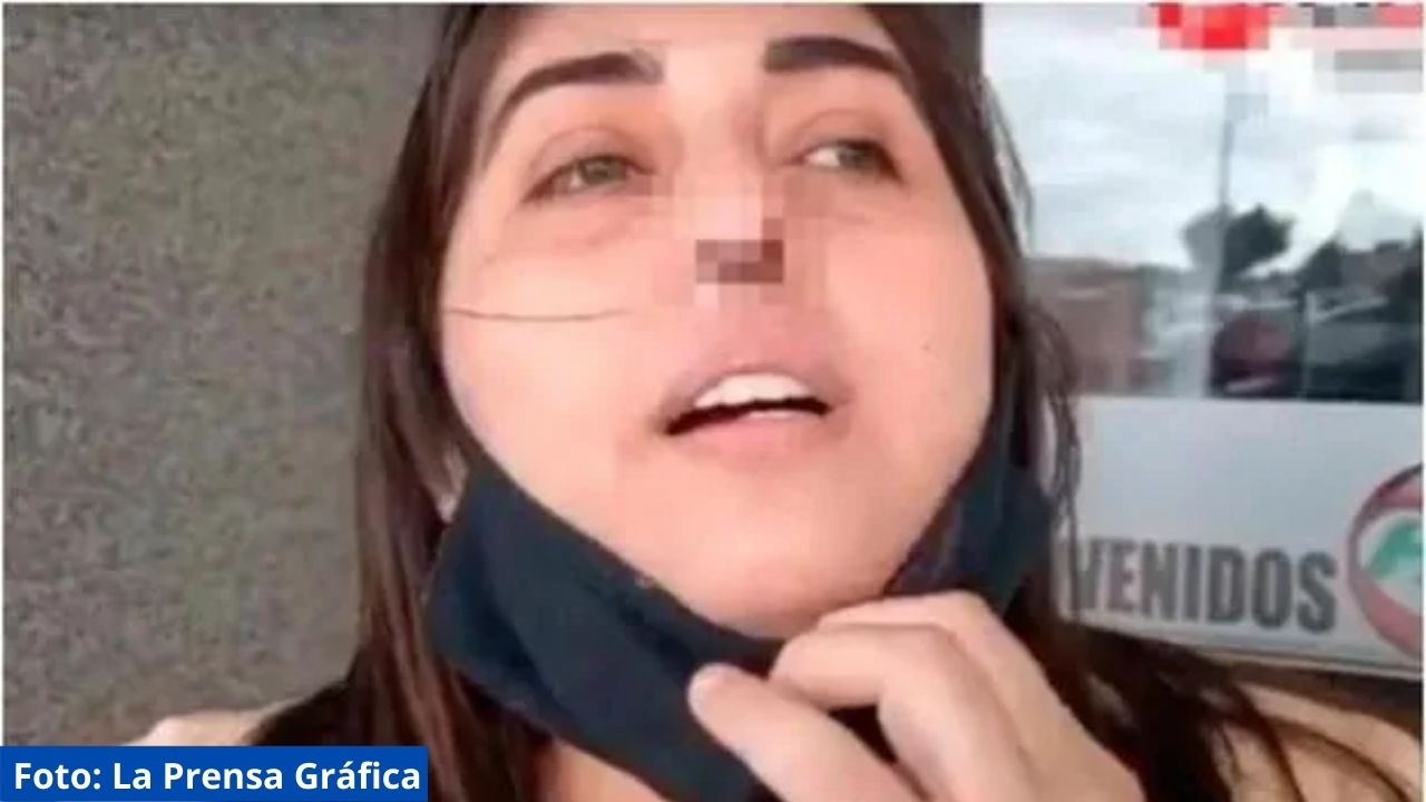 Mujer perdió cartílago de su nariz por un PCR mal realizado