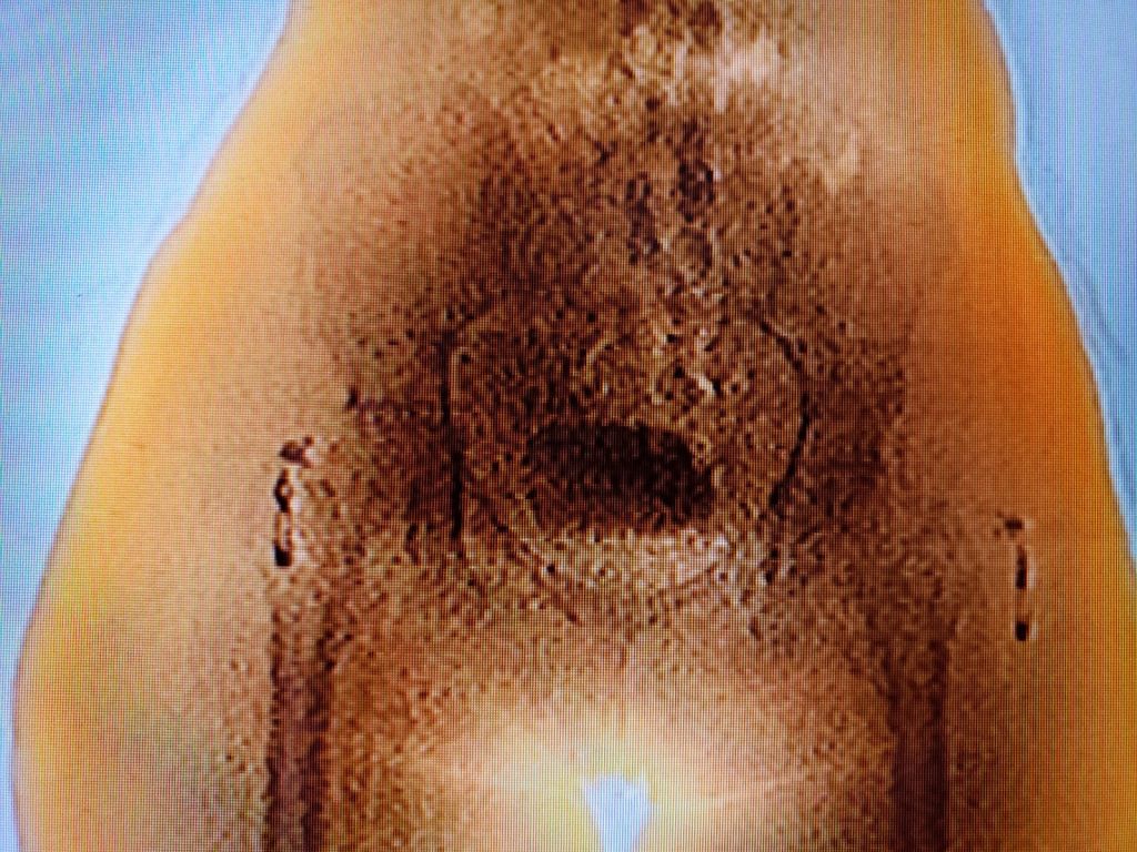 Imagen de cuerpo de nota