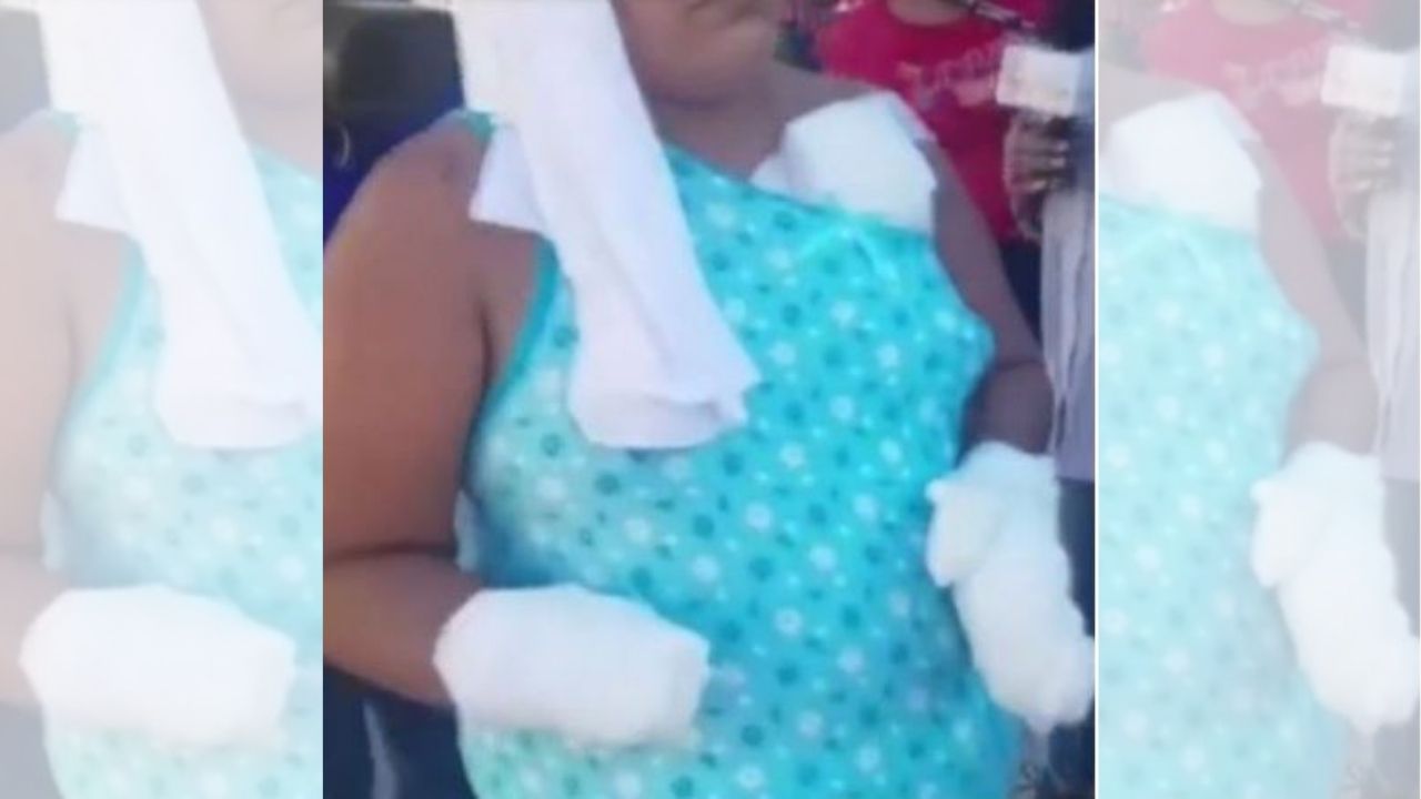 Lo que sabe la Policía del hombre que cercenó las dos manos a hondureña en Choluteca