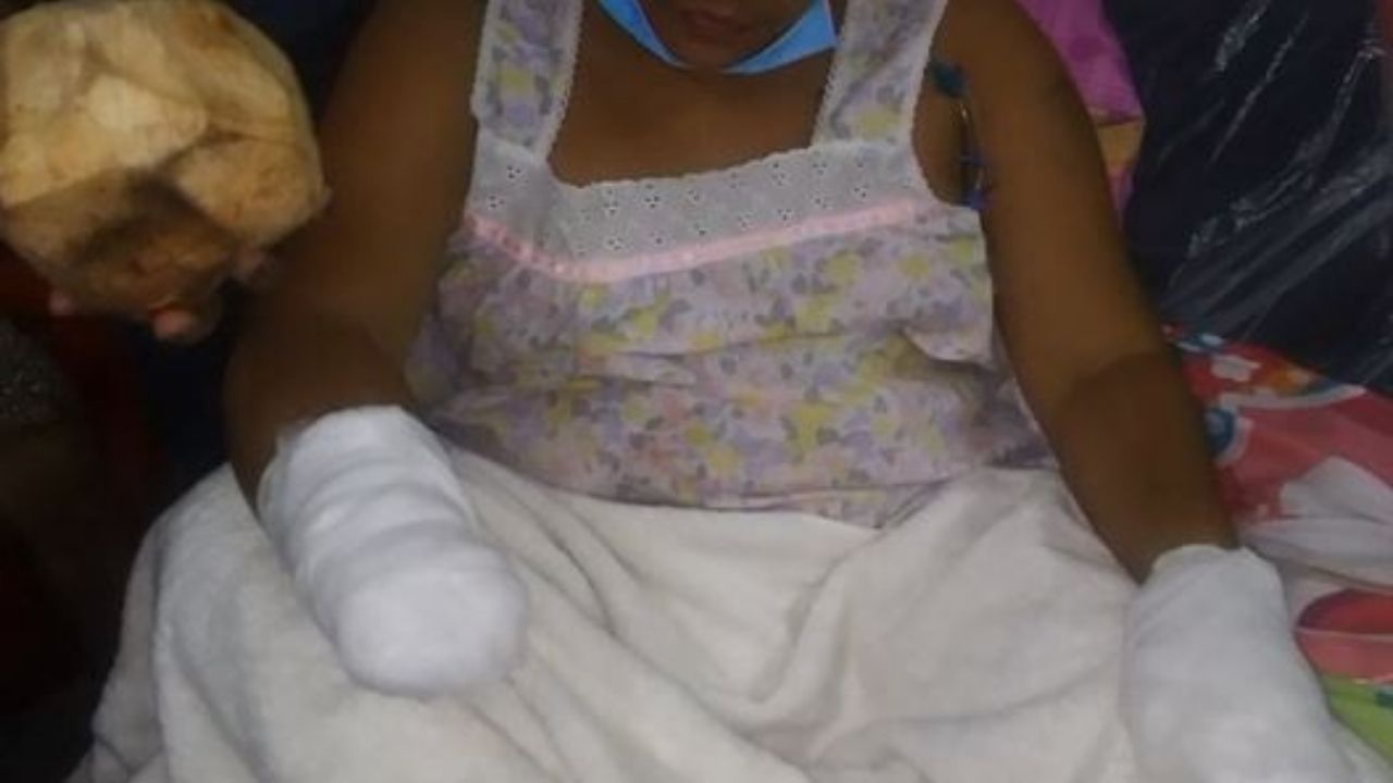 Hombre le cortó las dos manos porque lo rechazó; hondureña clama ayuda desde la cama de un hospital