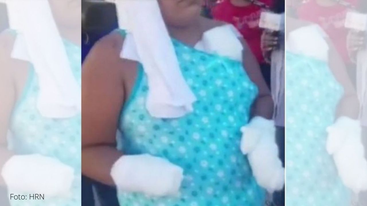 Fiscalía presenta requerimiento fiscal para hombre que cercenó las dos manos a mujer en Choluteca