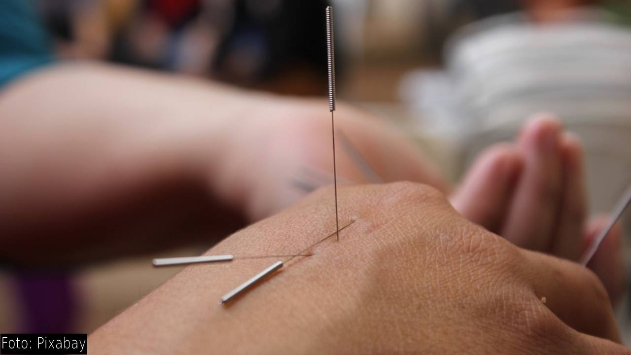 China introduce la acupuntura en su protocolo actualizado contra el covid
