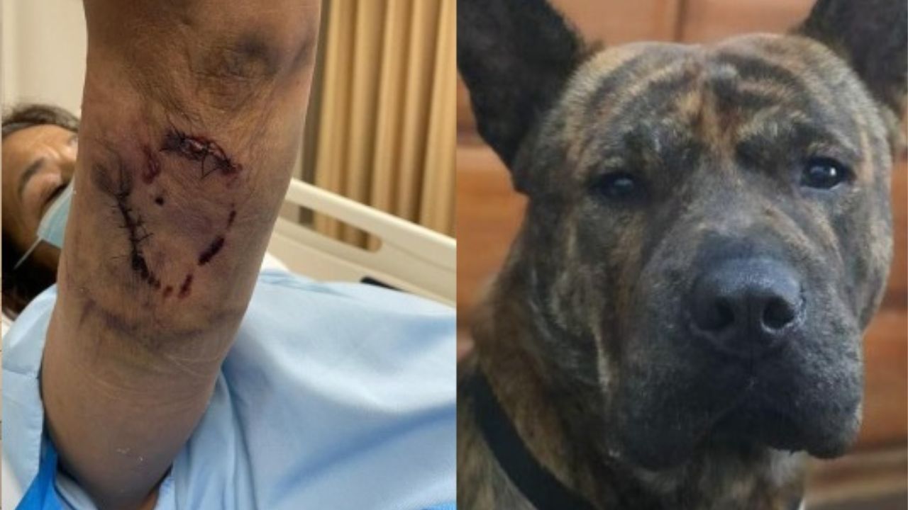 Anciana es sometida a cirugías y terapias tras ataque de perro que ya suma 5 víctimas