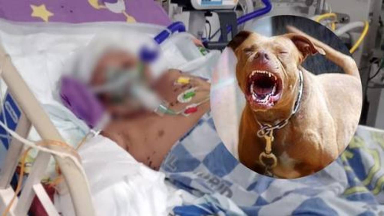 Hospital Escuela ha atendido a 16 pacientes mordidos por perros, 13 de ellos menores de edad