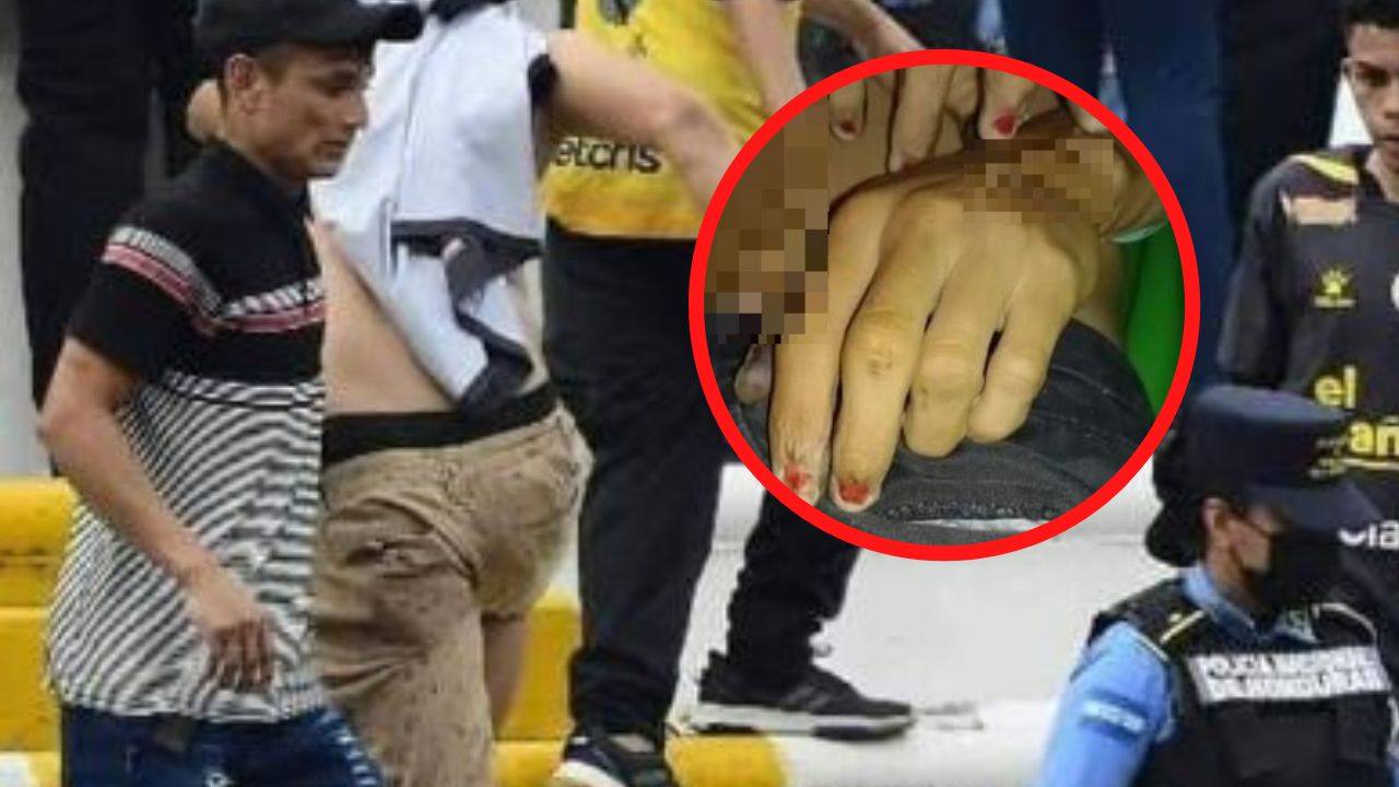 ¿A Wilson Pérez le arrancaron las uñas?, esto revelan de su cuerpo desde la Secretaría de Seguridad