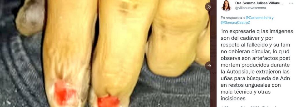 Imagen de cuerpo de nota