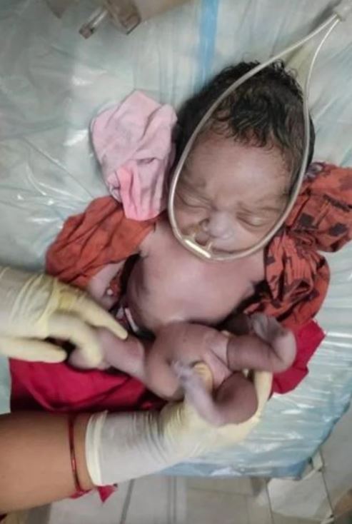 Imagen de cuerpo de nota