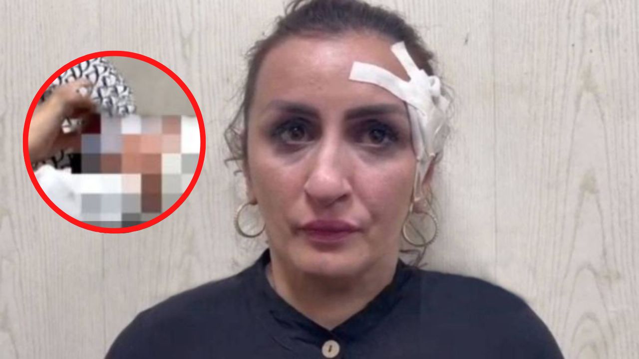 Madre vendió a su bebé para realizarse una cirugía estética y esta fue su justificación