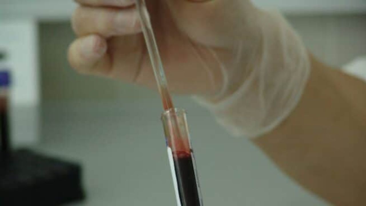 Un caso único de curación funcional del sida amplía las vías de investigación