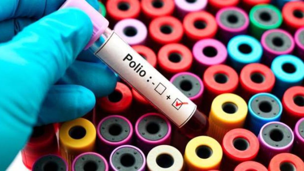 Guatemala alerta a su población sobre virus de polio detectado en Estados Unidos