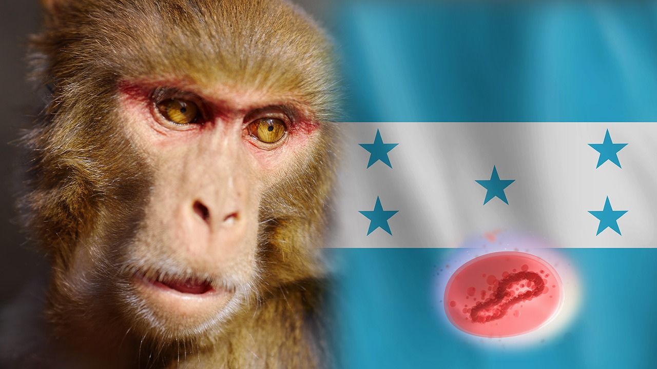 Se confirma el primer caso de viruela del mono en Honduras