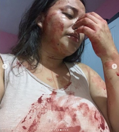 Imagen de cuerpo de nota