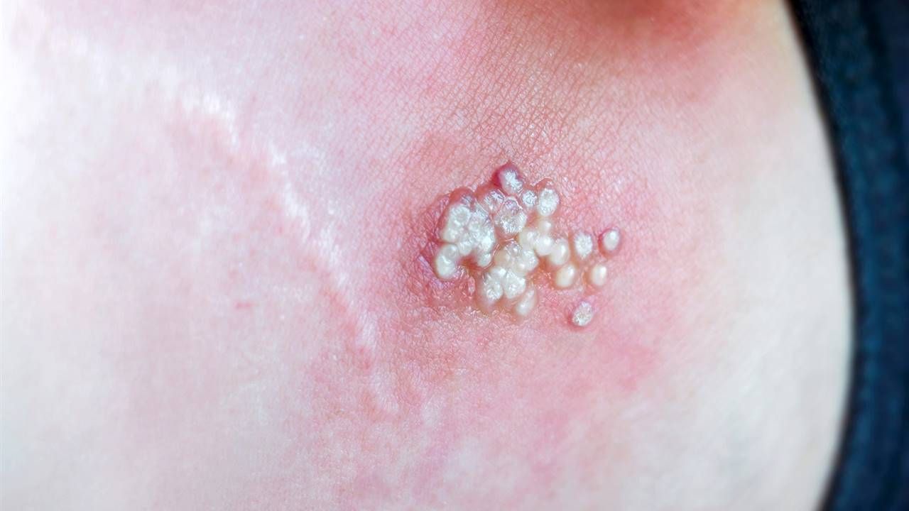 Imagen de cuerpo de nota