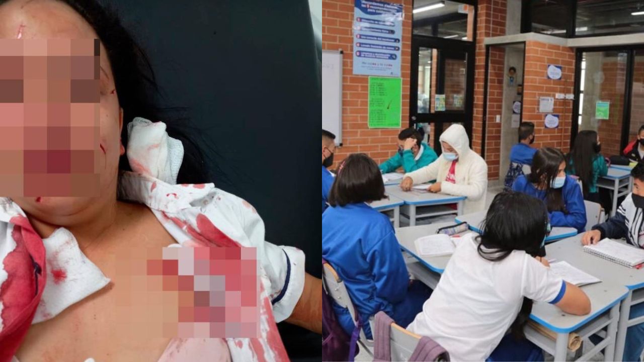 Adolescente agredió con una cuchilla a su compañera de clases en Colombia