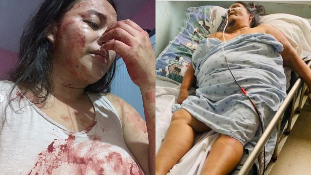 Madre e hija fueron brutalmente atacadas a machetazos por un hombre en La Masica, Atlántida