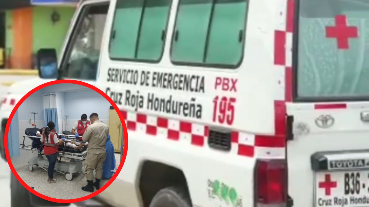Hondureña habría rociado su cuerpo con gasolina y prendido fuego tras discutir con su pareja