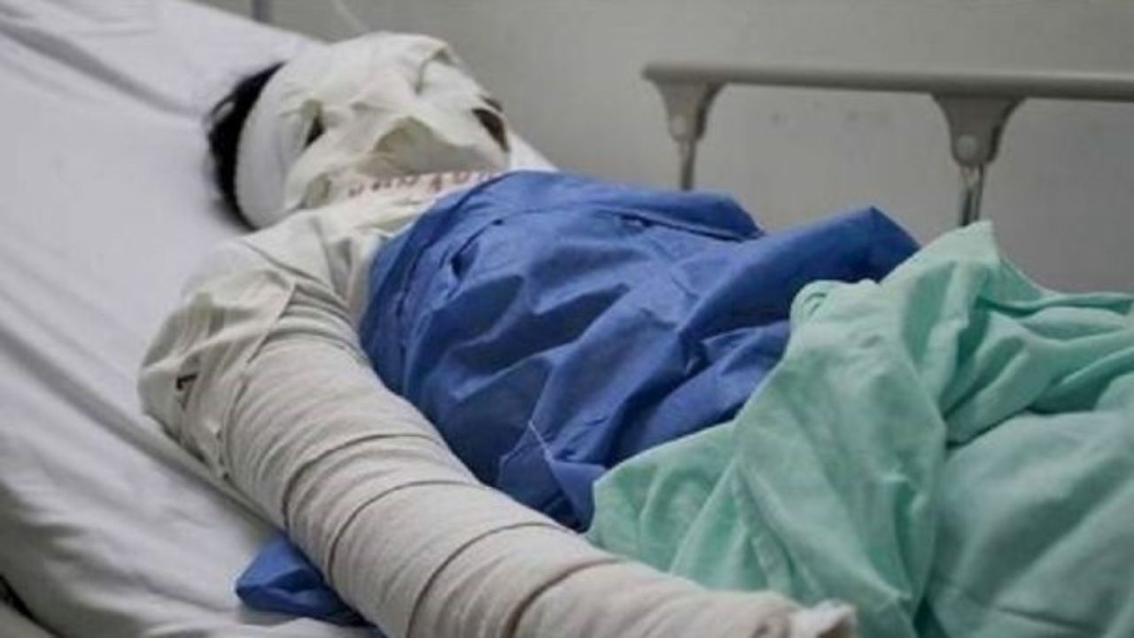 Madre roció alcohol y le prendió fuego a su propio hijo en Argentina por esta razón