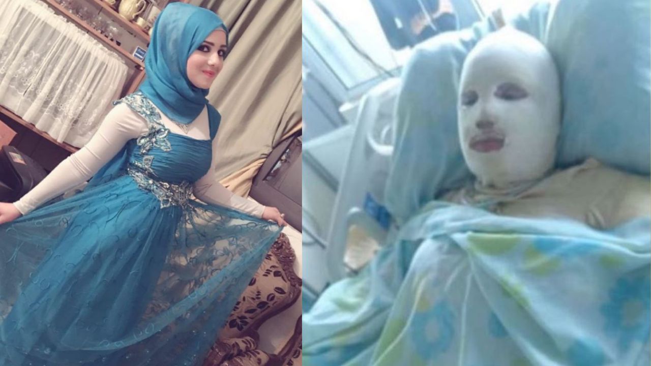 Embarazada de cinco meses murió tras ser quemada viva por su esposo por no querer abortar