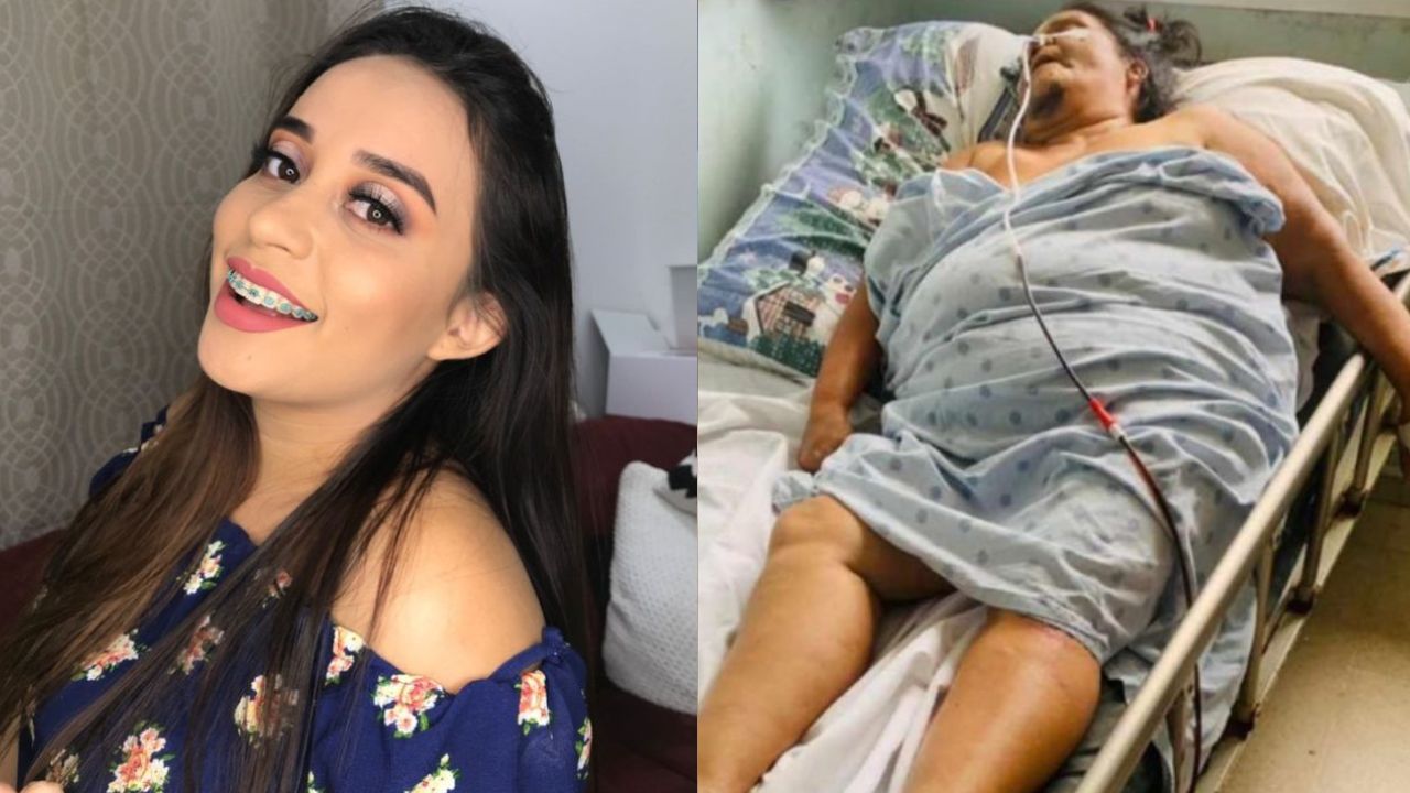 Muere la mamá de Lisbany León tras más de 15 días en coma por brutal ataque a manos de su exyerno