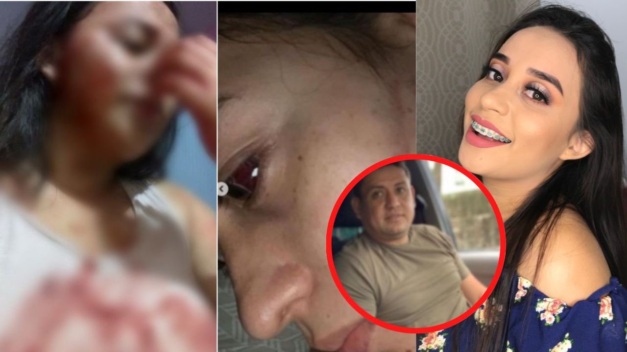 Hondureña Lisbany León denuncia que su expareja ha intentado asesinarla desde enero