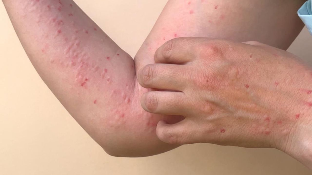 Imagen de cuerpo de nota