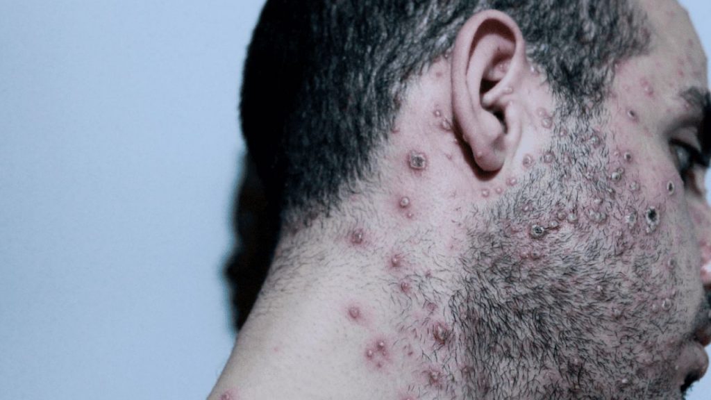 Imagen de cuerpo de nota