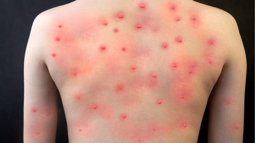 Imagen de cuerpo de nota