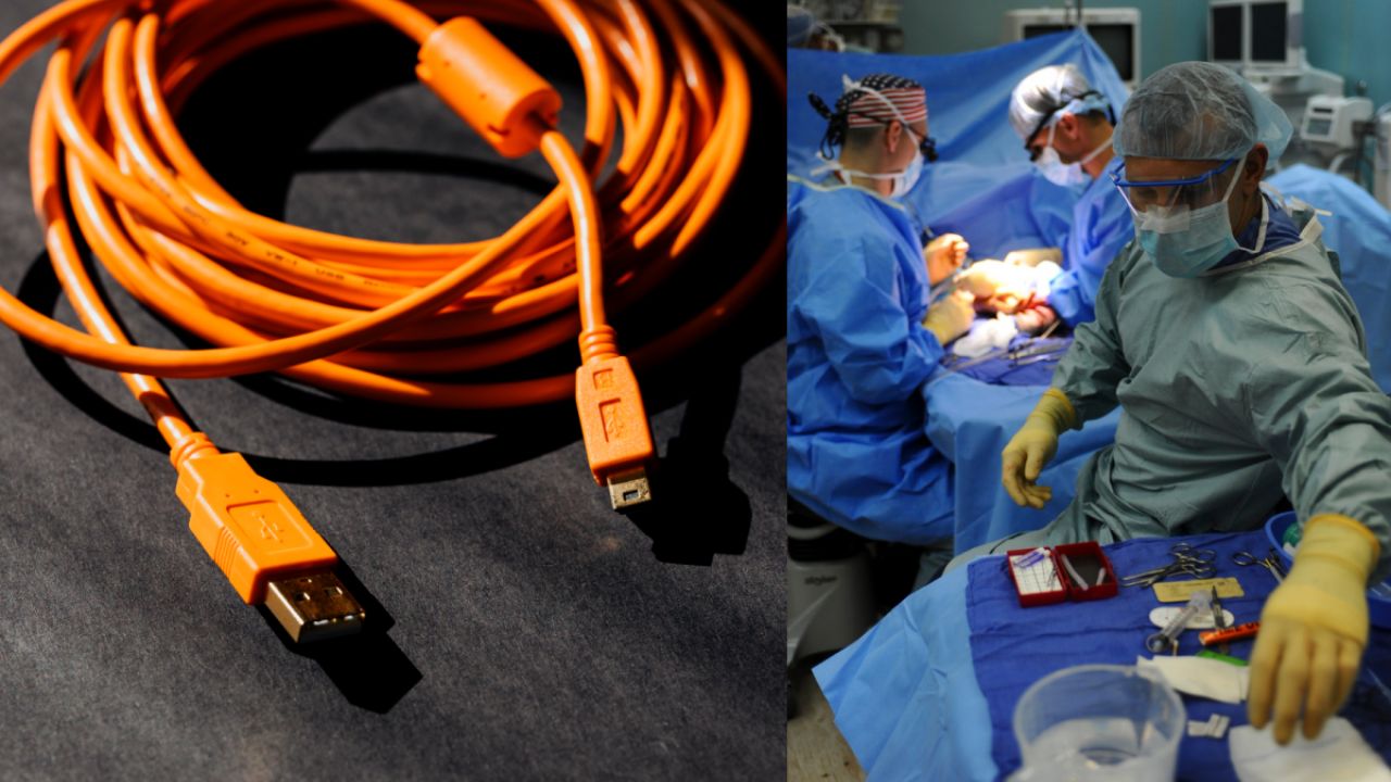 Joven se introdujo cable USB en su miembro viril por curiosidad y el experimento le salió mal