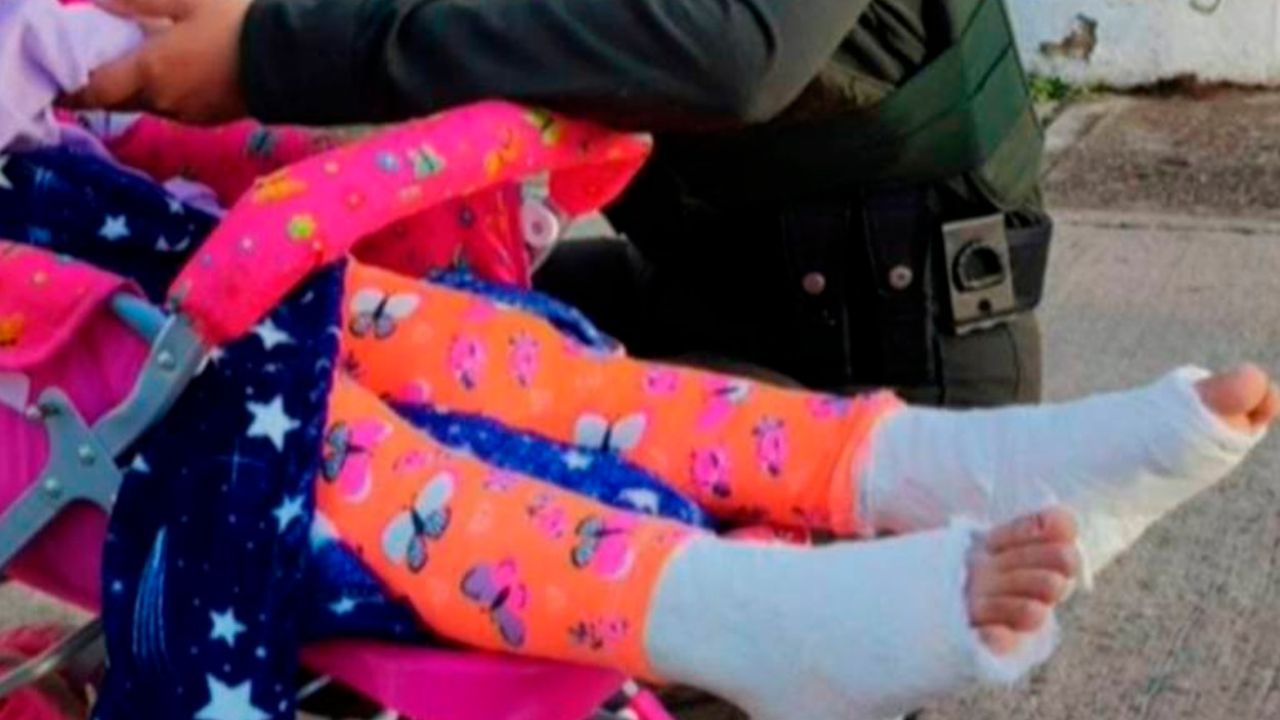 Mujer enyesaba las piernas de su hija para pedir limosna y fue detenida en Colombia