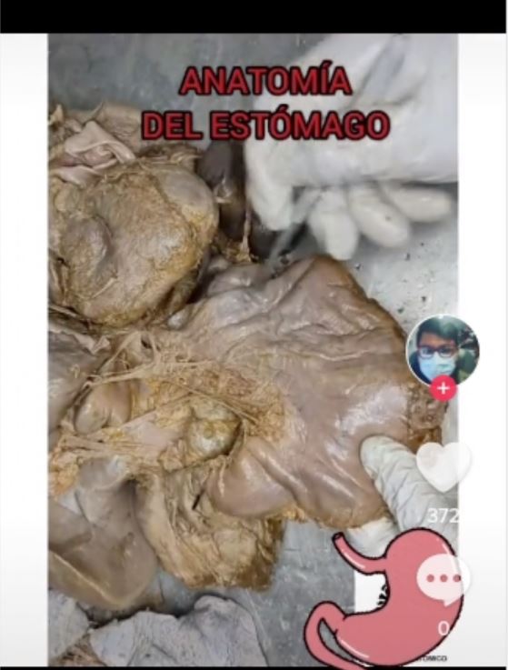 Imagen de cuerpo de nota